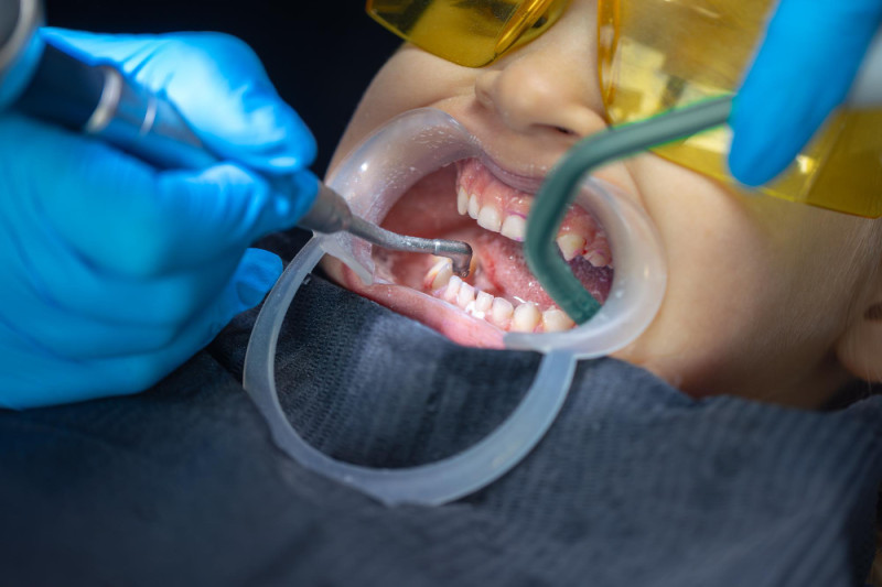 Negligencias dentales en el tratamiento