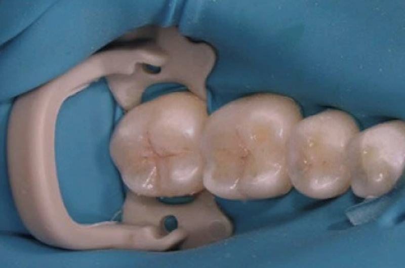 Negligencias dentales en la higiene y seguridad